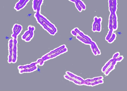 Broken chromosomes